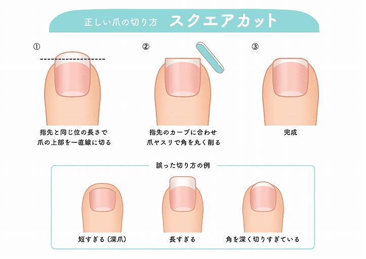 正しい爪の切り方をする