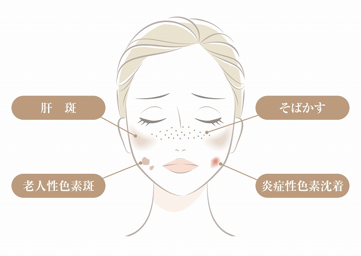 しみの種類で治療法は異なる